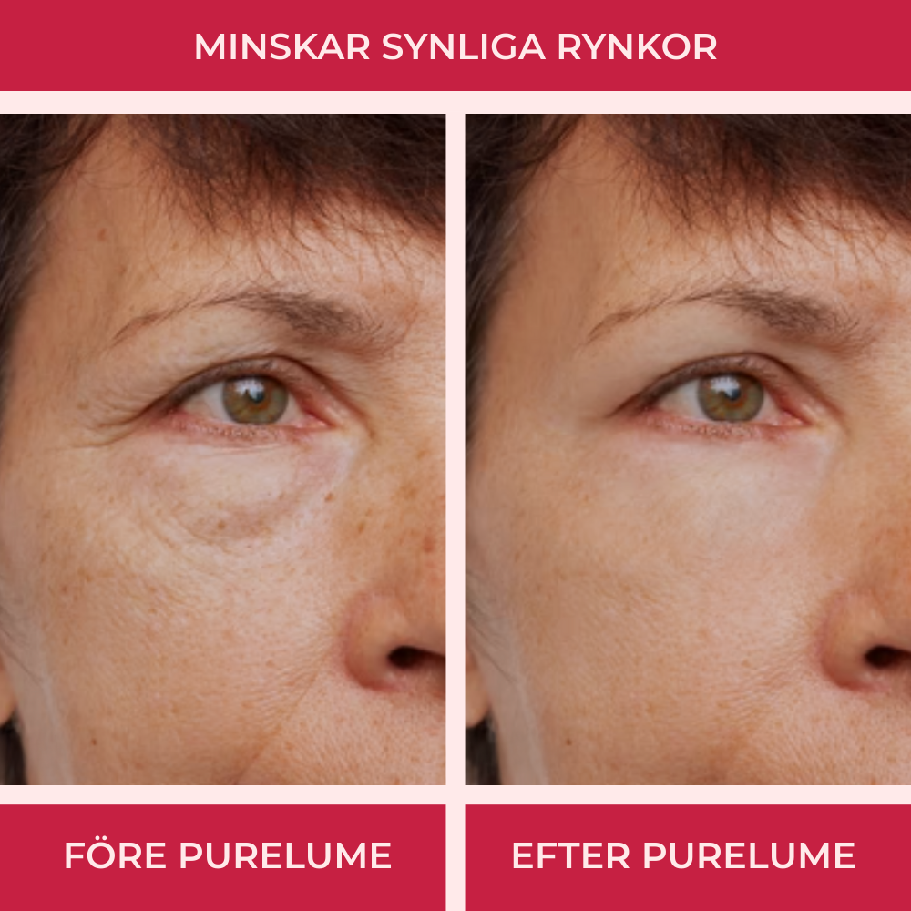 Purelume® LED-mask – 7-färgs ljusterapi för ansikte